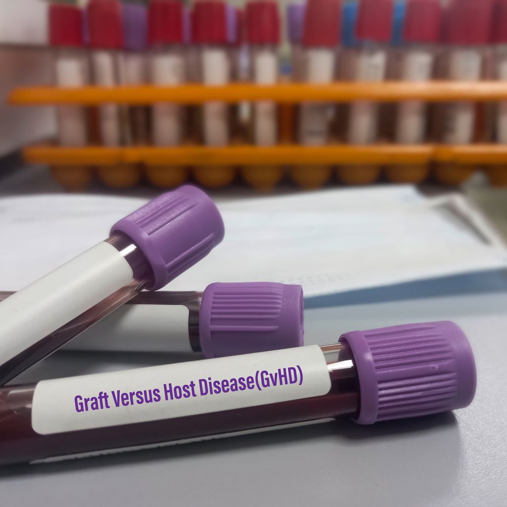 **Neue S3 Leitlinie Zur Sepsis: Warum Ihre Bisherige Behandlung Möglicherweise Falsch War.** - krd8k04